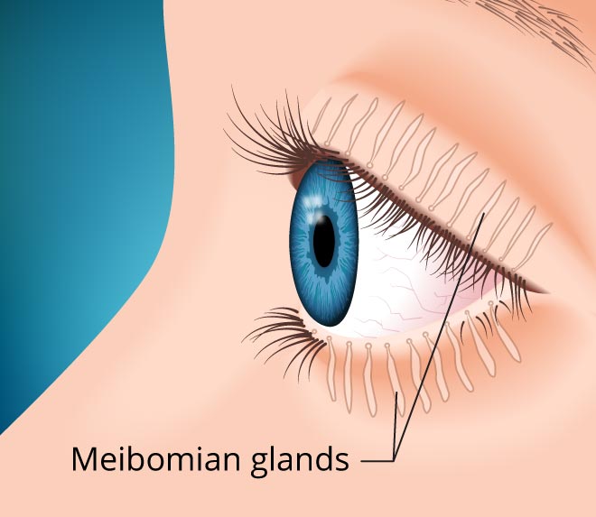 File:Meibomian-glands-.jpg